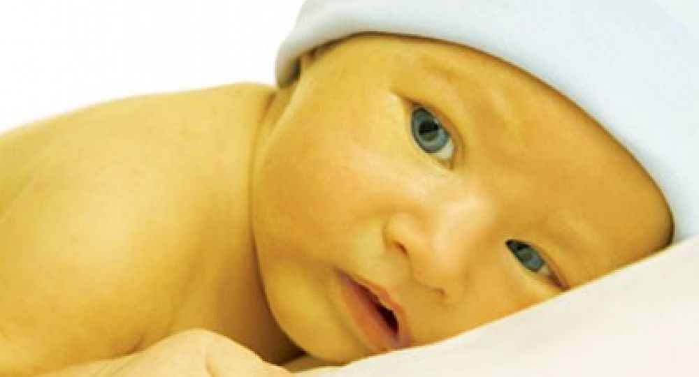 Cómo identificar la ictericia en el recién nacido - Sifeme
