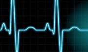 Afirman que electrocardiogramas pueden predecir futuros infartos en ancianos