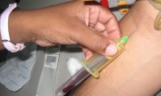 Comienza la “Semana de la Hepatitis” con extracciones y actividades para concientizar sobre el virus