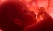  Hasta en un 4% de los embarazos se producen anomalías que pueden comprometer la vida del feto