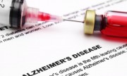 Prueba de sangre predeciría Alzheimer