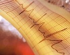 Una revisión sugiere que tener un latido cardiaco irregular duplica el riesgo de sufrir 'ACV silenciosos'