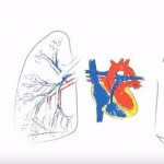 Hipertensión pulmonar, una enfermedad grave que se diagnostica poco